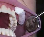 Cotton Rolls Dental/Medical #2 Medium Non Sterile 100% Absorbent  SUCR