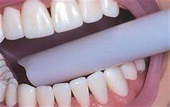 Dental Disposable Hight-Volume Vented Evacuation Tips Latex Free  SUST